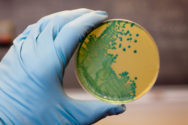 Retka i opasna bakterija pronaðena u omiljenom srpskom specijalitetu VIDEO